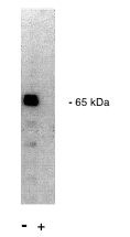 Legend: Exalpha’s rabbit anti PP 2A/A antibody western blot of total rat brain homogenate. (+) indicates blocking by specific peptide.